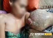 Terbaring Lemas, Keluarga Addus Butuh Uluran Tangan Bupati 19 Terbaring Lemas, Keluarga Addus Butuh Uluran Tangan Bupati