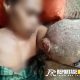 Addus (26), asal Desa Pajenangger, Kecamatan Arjasa, Kabupaten Sumenep, terbaring lemas karena penyakit yang diderita.