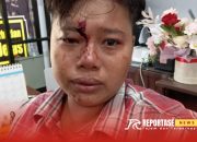 Diduga Aniaya Perempuan, Oknum Satpol PP Sampang Dilaporkan ke Polisi 11 Diduga Aniaya Perempuan, Oknum Satpol PP Sampang Dilaporkan ke Polisi