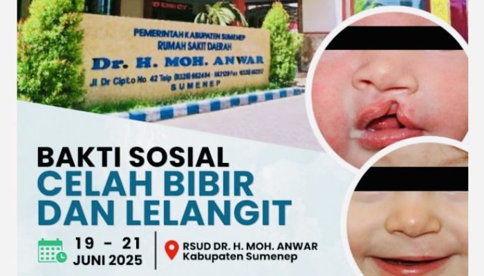 Kolaborasi RSUD dr. H. Moh. Anwar, UNAIR, dan PDGI Gelar Pengabdian Medis di Sumenep