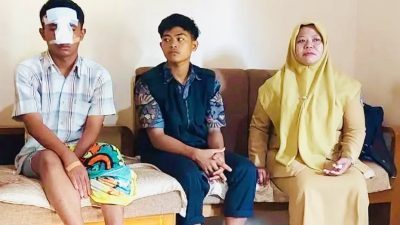Dugaan Kekerasan Terhadap Anak di Bawah Umur: Pelajar SMK di Blitar Jadi Korban Pemukulan, Tulang Hidung dan Bawah Mata Retak